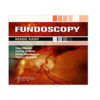 Fundoscopy Made Easy 1st Edition